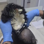 colombian-police-catch-man-smuggling-packets-of-cocaine-under-toupee