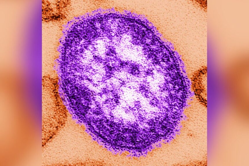 who-says-european-region-saw-highest-number-of-measles-cases-in-decades