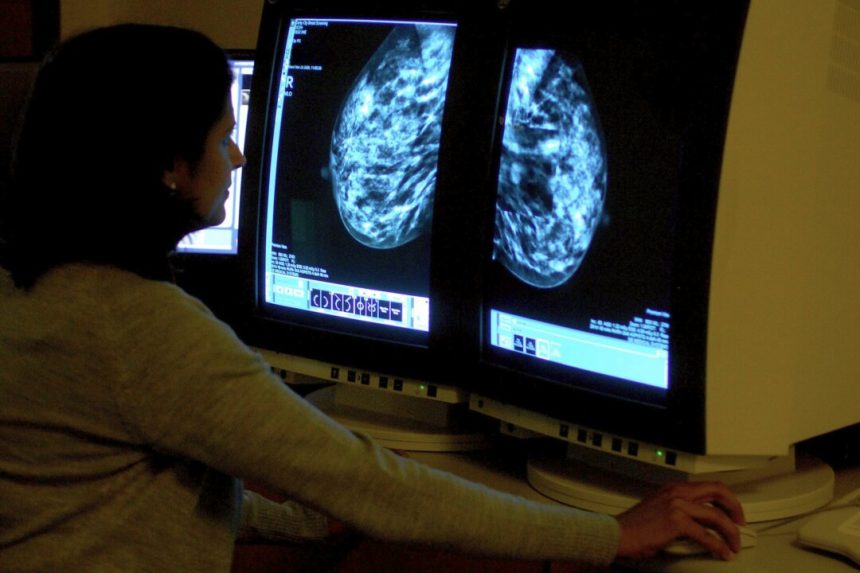 experts-warn-that-uk-cancer-care-system-is-at-‘critical-breaking-point’