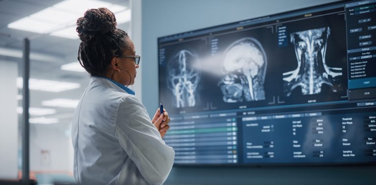 brains-of-people-with-schizophrenia-may-age-faster-–-how-our-research-adds-to-the-evidence
