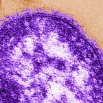 manitoba-warns-of-new-measles-exposure-sites-south-of-winnipeg