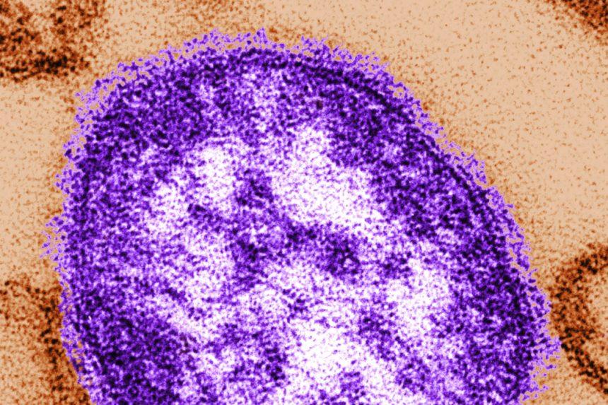 manitoba-warns-of-new-measles-exposure-sites-south-of-winnipeg