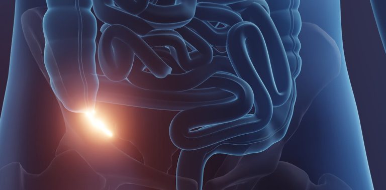 why-the-appendix-is-much-more-important-than-we-once-thought