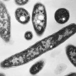 3-in-hospital-after-diagnosed-with-legionnaires’-disease-in-sydney