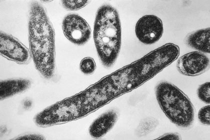3-in-hospital-after-diagnosed-with-legionnaires’-disease-in-sydney