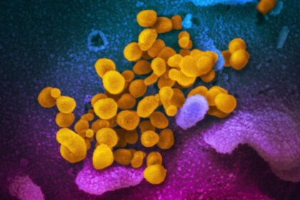 covid-19-pandemic-accelerated-brain-aging-even-in-people-who-didn’t-get-virus:-study