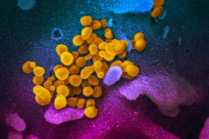 covid-19-may-increase-aging-of-blood-vessels-among-women:-study