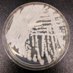 multidrug-resistant-fungus-spreading-rapidly-in-europe:-ecdc