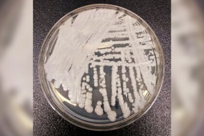 multidrug-resistant-fungus-spreading-rapidly-in-europe:-ecdc