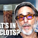 calamari-clots-part-3:-a-unique-and-dangerous-protein-signature