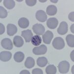 southeastern-ontario-health-unit-probes-114-cases-of-parasitic-stomach-illness