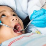 the-mysterious-tooth-condition-affecting-millions-of-children