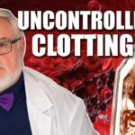 dr.-bruce-rapley:-mechanisms-&-dangers-of-anomalous-clots
