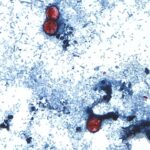 no-cyclospora-outbreaks-reported-or-tainted-lettuce-sold-in-canada,-officials-say